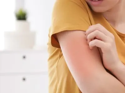 close-up image of someone with eczema on their arm, scratching their skin