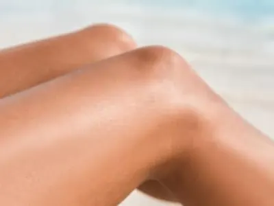 image of a person's legs after laser hair removal procedure