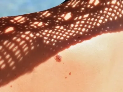 banner sundamage
