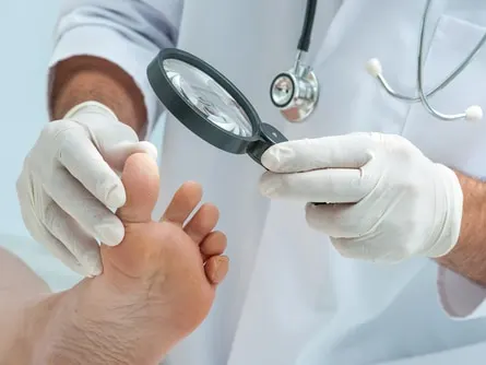 dermatologist examines the foot on the presence of athletes foot