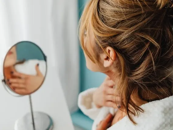 Rosacea symptoms (1)