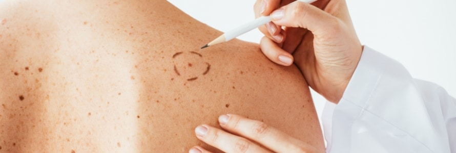 banner skincancer